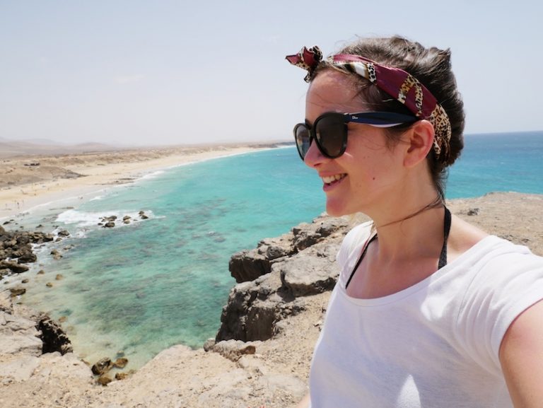 Staying safe in the sun and the best way to treat sunburn